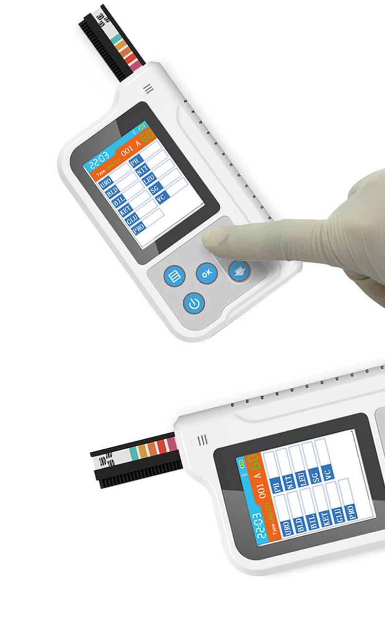 Portable Vet Urine Analyzer -  - Urine Analyzer Strip 评论和价格